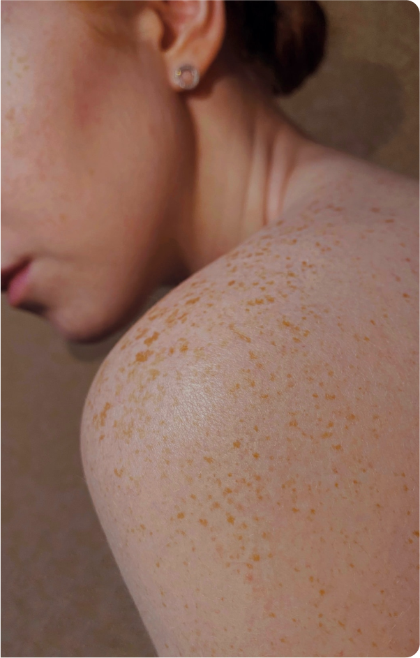 dermatology